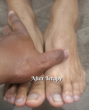 Jasa Pijat Kretek Kretek Bubutan Surabaya