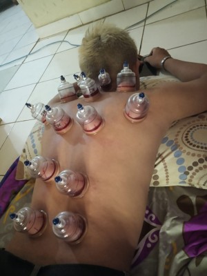 Bekam Ciangsana