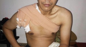 JASA PIJAT URUT PANGGILAN SARAF KEJEPIT,KESELEO,PATAH TULANG DI BOGOR